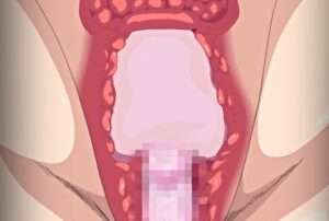 発情期の男の子の精子の量は信じられない！コンドームが膣内で破裂する危険がある！(私、先生、友達のお母さん*Ep.1）【エロ動画 天鹿】